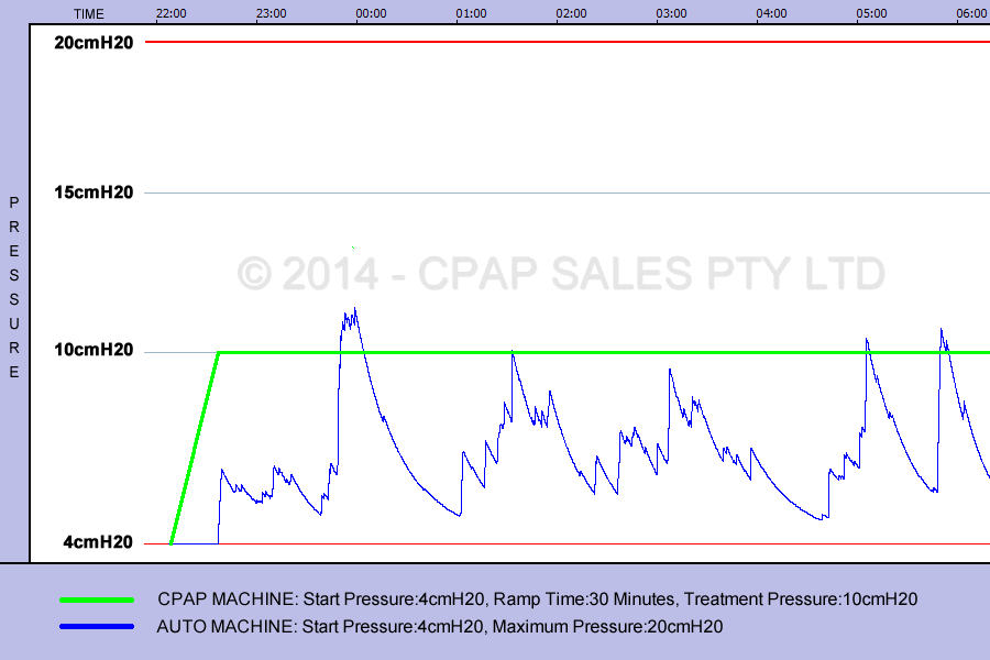 CPAP and Auto Machine Pressure Graph over 8 hour sleep period