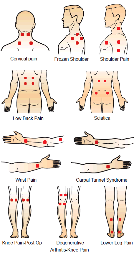 Pain-Care Treatment Areas